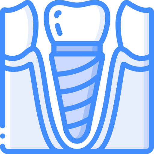 Implantologia tradizionale per la sostituzione dei denti mancanti